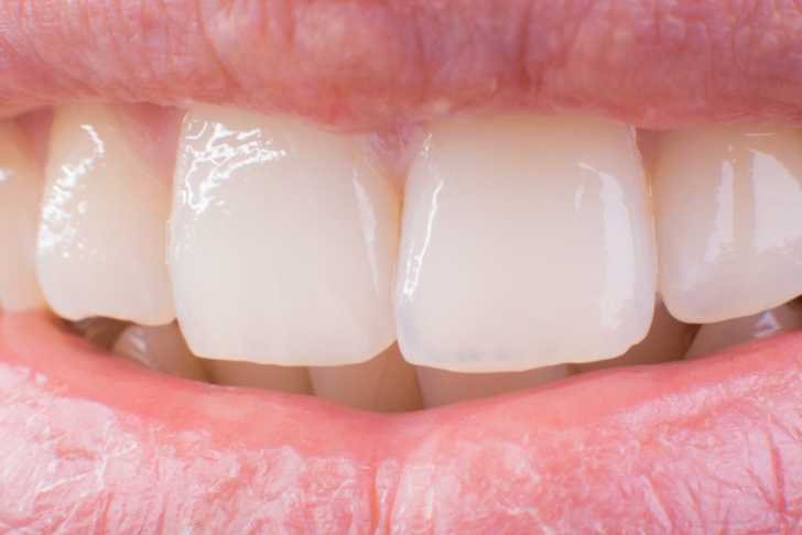 Use These Pantry Staples To Get Whiter Teeth